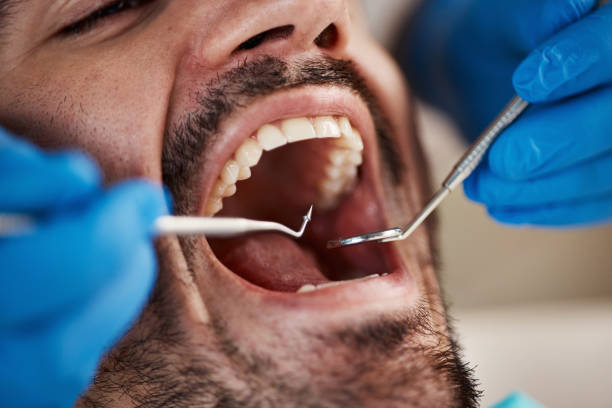 Best Broken Tooth Emergency  in Orchard Homes, MT